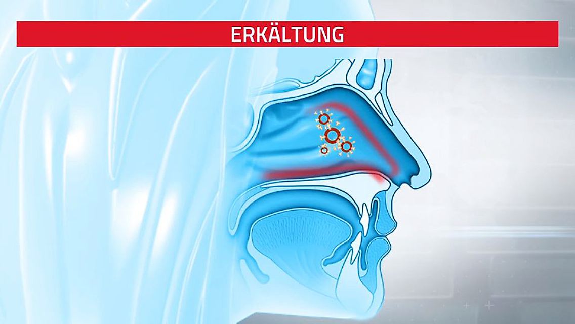 Erkältung.JPG