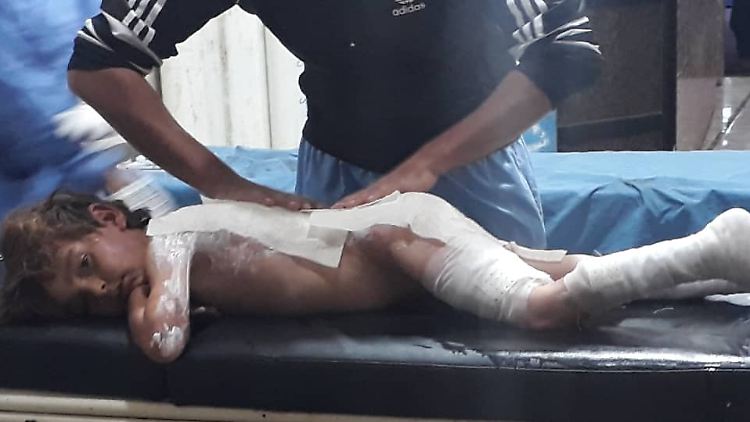 Ein verletztes Kind aus Ras Al Ain wird im Krankenhaus versorgt. 