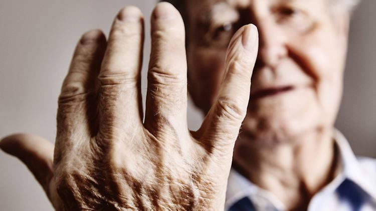 Arthritis ist eine entzündliche Gelenkerkrankung, die sehr schmerzhaft sein kann.