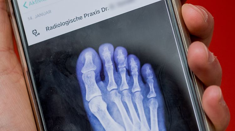 Röntgenbild in der digitalen Krankenakte: Auch darauf sollen Forscher Zugriff erhalten.