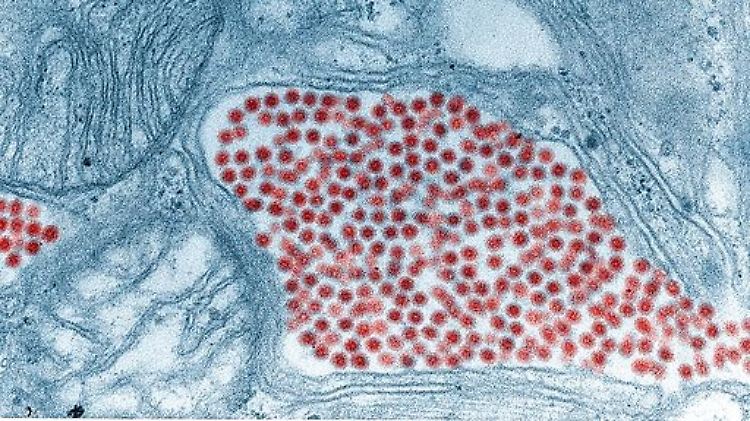 Der EEE-Virus (rot) steckt in der Speicheldrüse einer Stechmücke, aufgenommen mit einem Elektronenmikroskop.