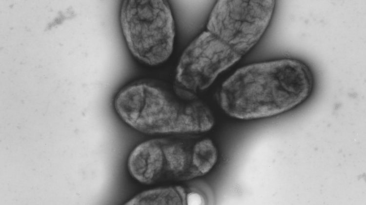 Die Pest wird vom Bakterium Yersinia pestis verursacht.