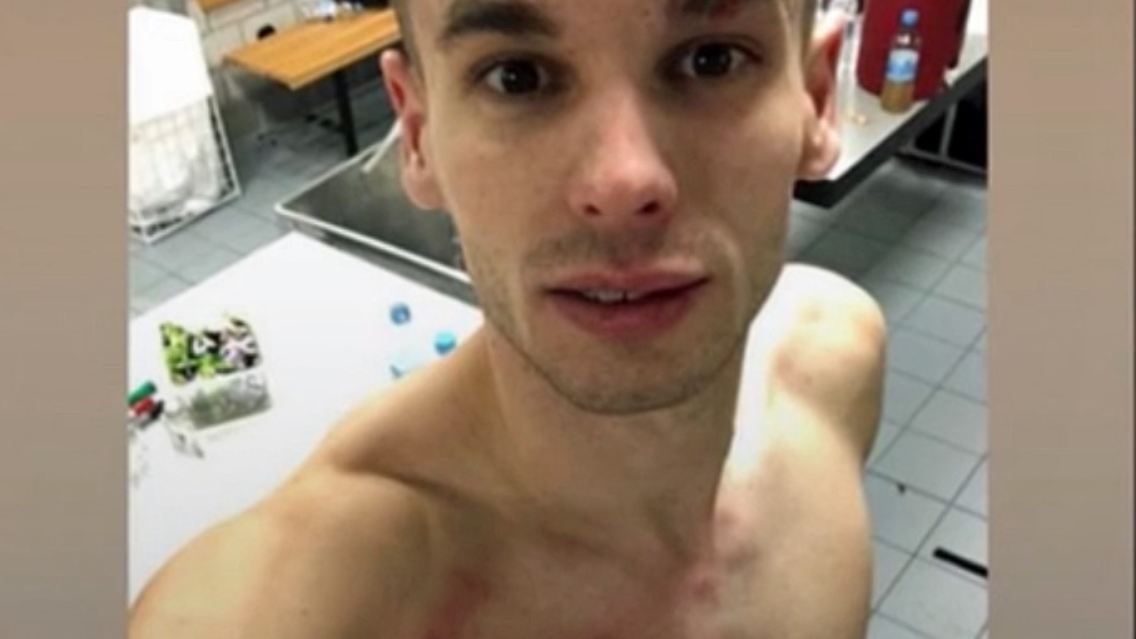 gacinovic nach foul.jpg
