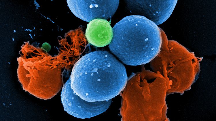 Rasterelektronenmikroskopische Aufnahme von intakten MRSA (blau), durch die Wirkung von PK150 induzierte Vesikelbildung (grün) und durch PK150 zerstörte MRSA (rot).