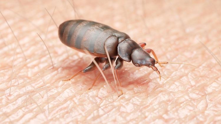 Lästig: Bettwanzenbisse jucken und können sich entzünden.