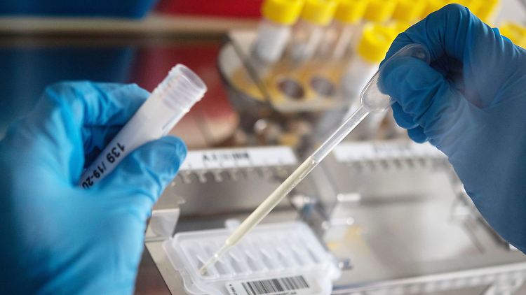 Bisher sind in dieser Saison rund 98.500 Grippe-Infektionen nachgewiesen worden.