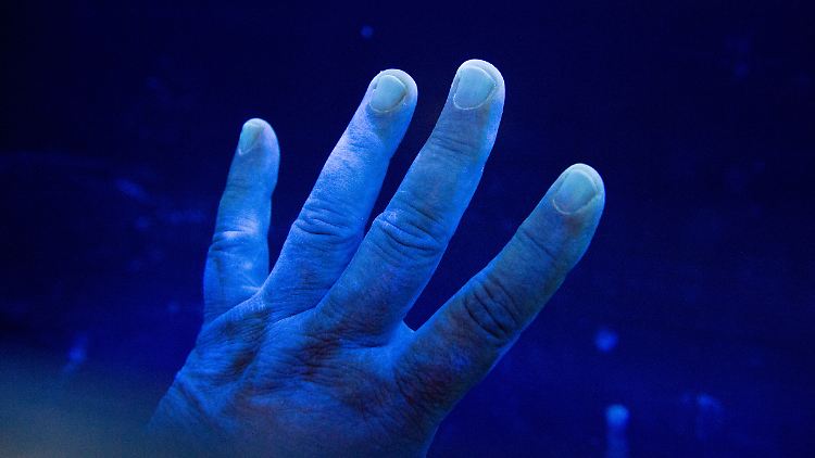 Hand unter einer UV-Lampe - zuvor wurde sie mit einem Desinfektionsmittel gereinigt, an die dunklen Stellen ist keins gelangt. Durch die Verbreitung des neuen Coronavirus nimmt die Benutzung von Desinfektionsmitteln derzeit zu.