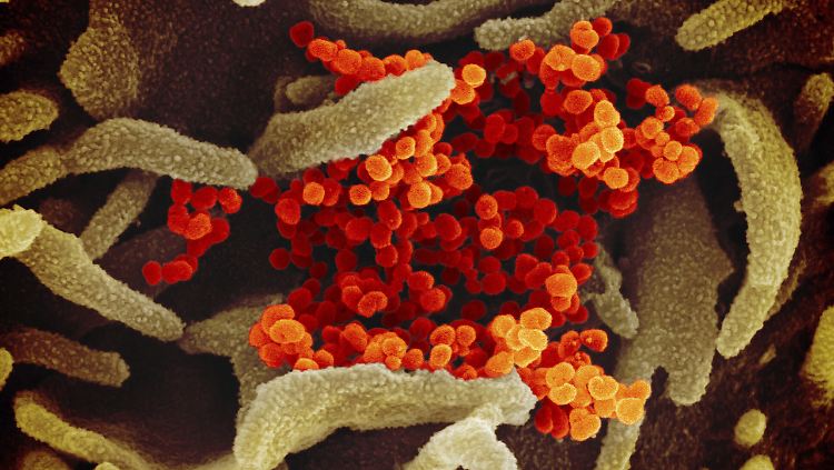 "Wir können die Idee nicht völlig beiseite wischen, dass das Virus in der Lage ist, eine bestimmte Strecke in der Luft zurückzulegen", sagt US-Immunologe Anthony Fauci.