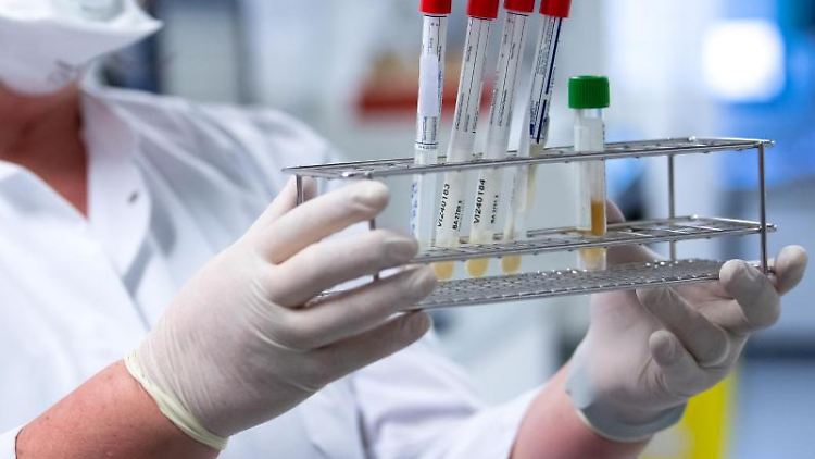 Eine Mitarbeiterin bereitet Proben von Menschen mit Covid-19-Verdacht in einem Labor vor.