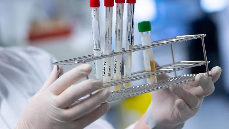 Eine Laborantin führt Tests auf das Coronavirus durch. 
