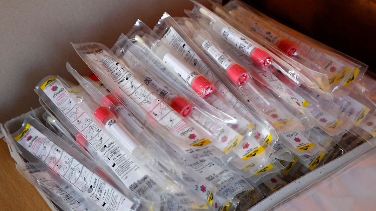 Bis zu 400.000 Tests sollen nach der neuen Methode möglich sein - pro Tag.