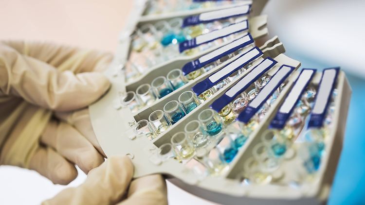 Antikörpertests sind laut Professor Drosten derzeit noch nicht zuverlässig genug. 