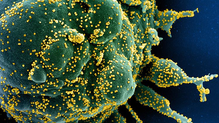 Nahaufnahme: Eine Zelle (grün) ist mit dem Coronavirus (gelb) infiziert.