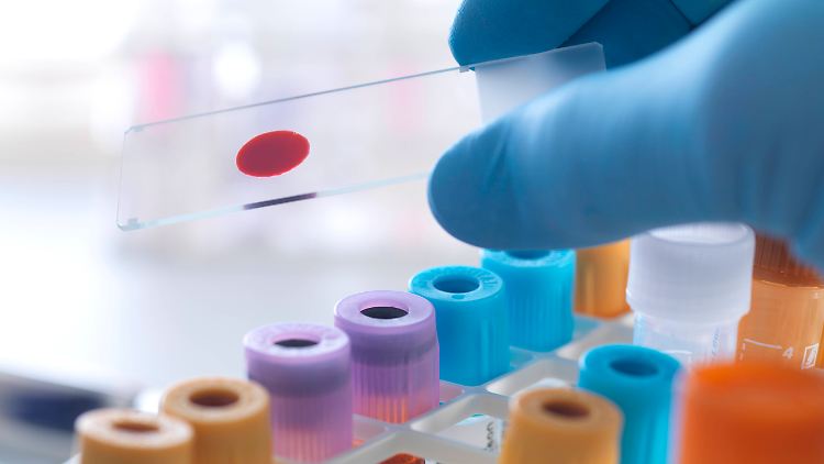 Wie das Virus den Menschen attackiert, untersuchen Pathologen im Labor.