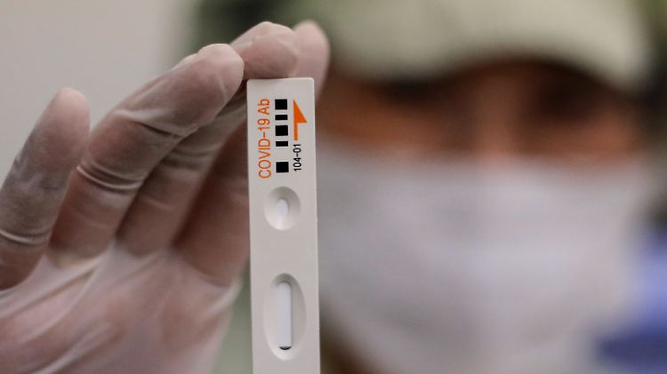 Regieren viele Tests auf Sars oder Mers, statt auf das Coronavirus?