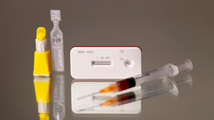 Corona-Antikörpertests wie dieser werden in Italien für eine großangelegte Studie geprüft.