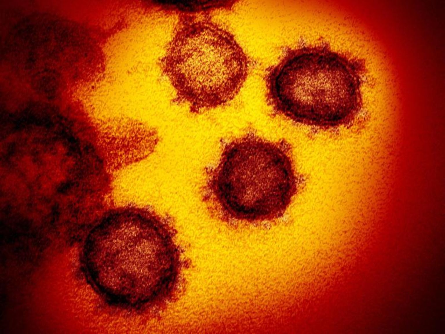 Sars-CoV-2 verbreitet derzeit Angst und Schrecken.