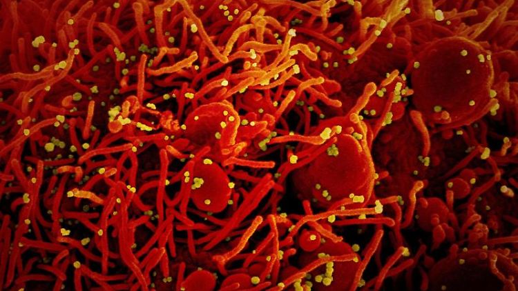 Das Coronavirus kann möglicherweise Organe so stark schädigen, dass sie schneller altern.
