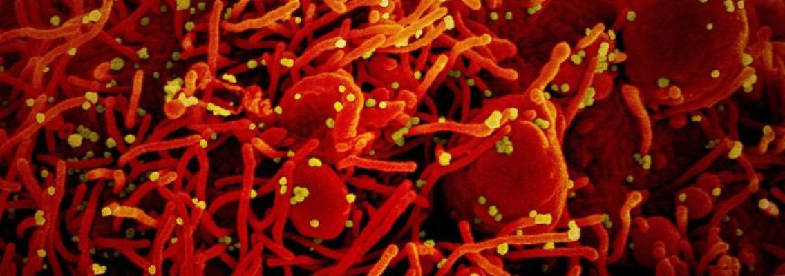 Auf dieser Aufnahme ist eine Zelle (rot) mit dem Coronavirus (SARS-CoV-2, gelb) infiziert. Foto: Niaid/Europa Press/dpa