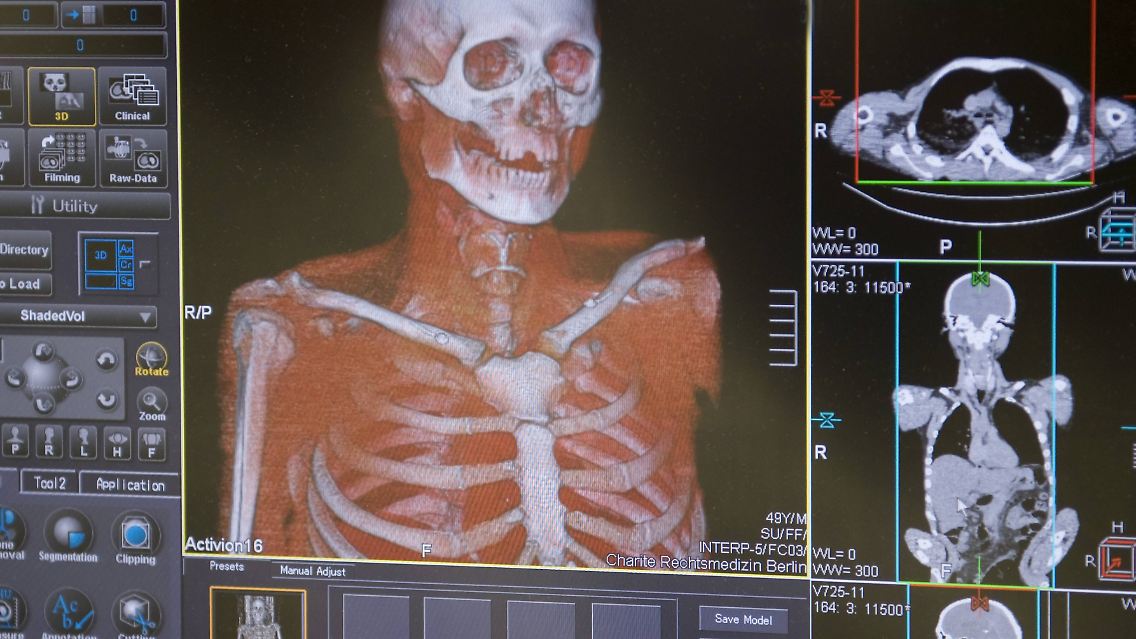 Obduktions-Scanner der Pathologie in der Charité.
