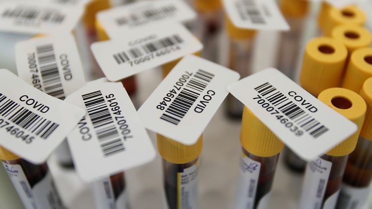 Weltweit suchen Wissenschaftler nach Medikamenten, um Covid-19-Patienten zu heilen.