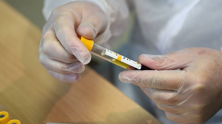 Die Labore in Deutschland übermitteln für den 11. bis 17. Mai einen Tiefstand an positiven Corona-Tests.