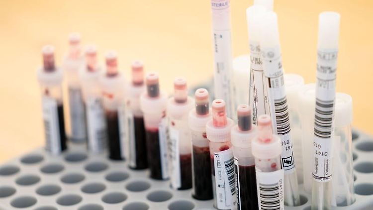 Blut ist auch bei der Immunantwort ein ganz besonderer Saft.