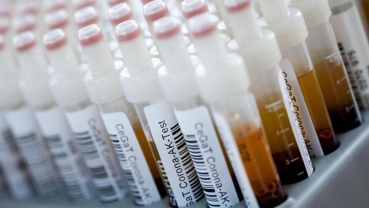 Röhrchen mit Blutproben für einen Corona-Antikörper-Test. 