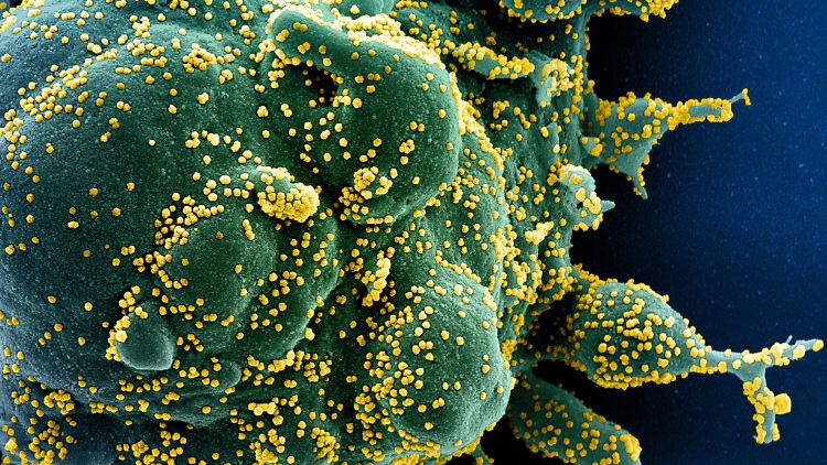 Eine menschliche Zelle (grün), die mit dem Coronavirus (gelb) infiziert ist. 