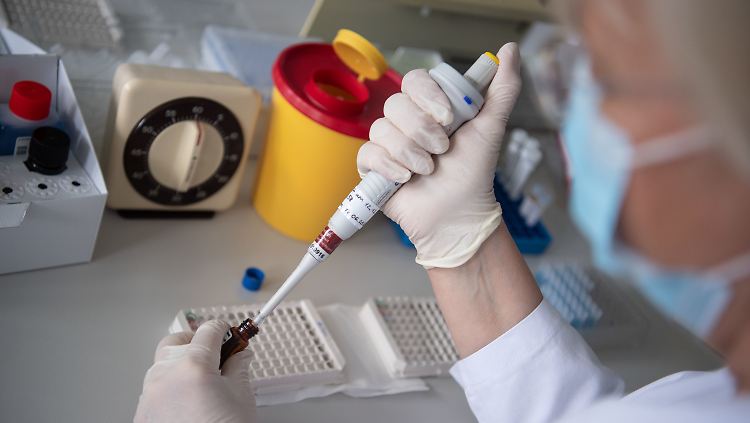Eine Laborantin testet eine Blutprobe auf Antikörper gegen das Coronavirus.