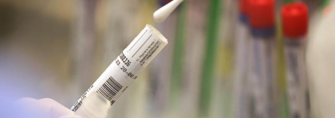 Ein Abstrich wird in einem Labor auf das Coronavirus untersucht. Foto: Oliver Berg/dpa/Symbolbild