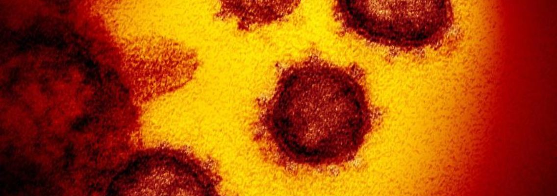 Eine undatierte elektronenmikroskopische Aufnahme des Coronavirus (SARS-CoV-2). Foto: NIAID-RML/AP/dpa/Archivbild