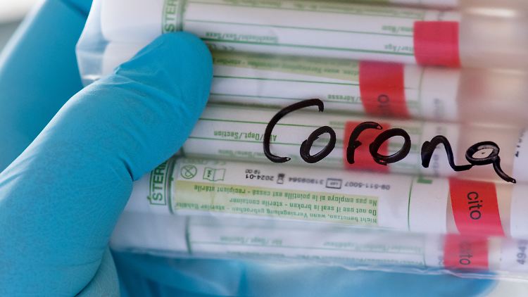 Derzeit ist für einen Corona-Test ein Abstrich vom Rachen nötig.