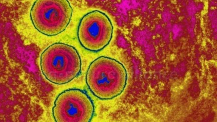 Einige HPV-Typen können zum Beispiel Gebärmutterhalskrebs auslösen.