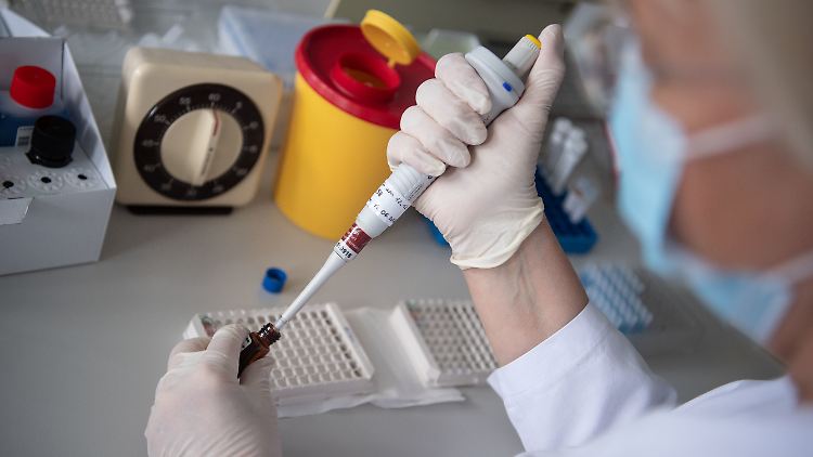 Eine Labor-Mitarbeiterin testet eine Blutprobe auf Antikörper.