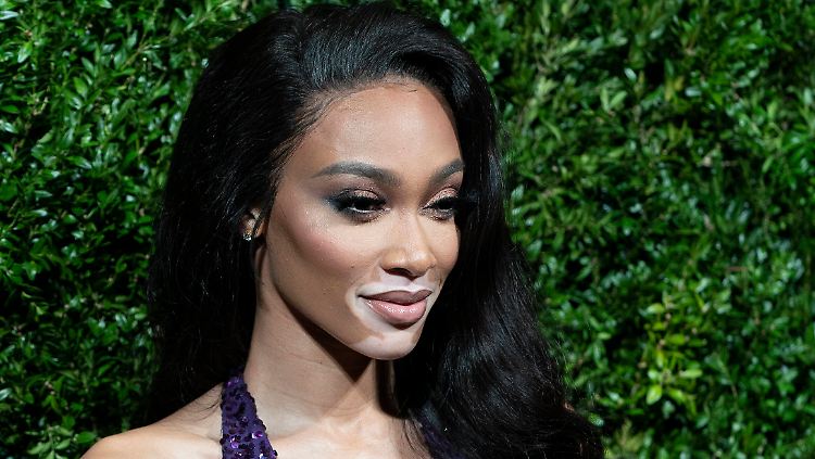 Lässt es sich gut gehen: Winnie Harlow.