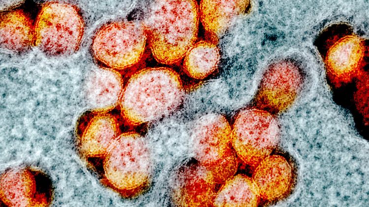 Das LY6E-Protein hindert Coronaviren - auch Sars-CoV-2 (im Bild) - daran, eine Infektion auszulösen.