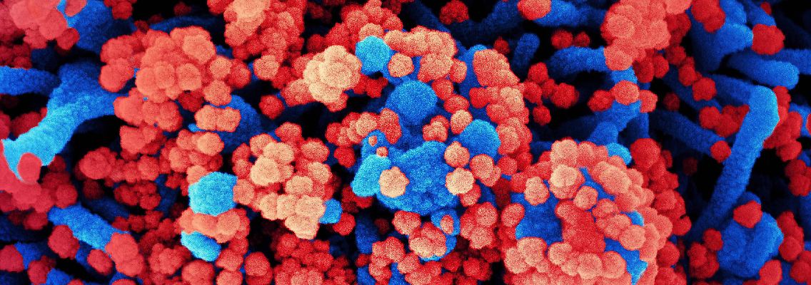 Coronavirus Kreuzeffektivität.jpg