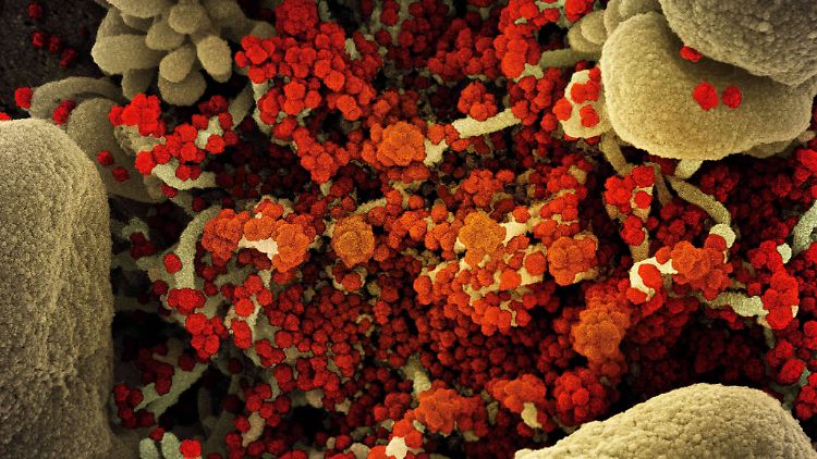 Das Coronavirus ist noch nicht enträtselt, aber die Medizin hat dazugelernt.