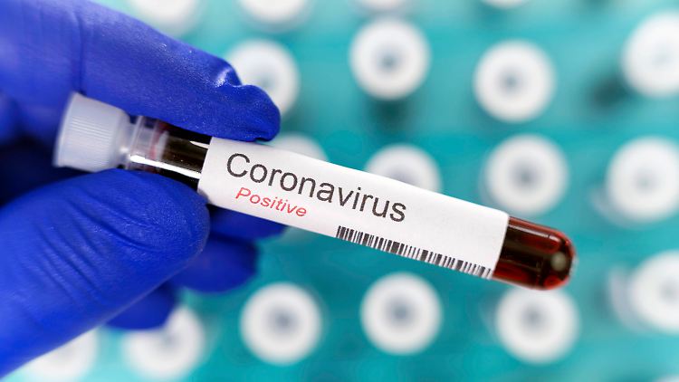 Bei den Studienteilnehmern, die trotz Infektion keine Antikörper gebildet haben, suchen die Forscher nun nach anderen Abwehrzellen.