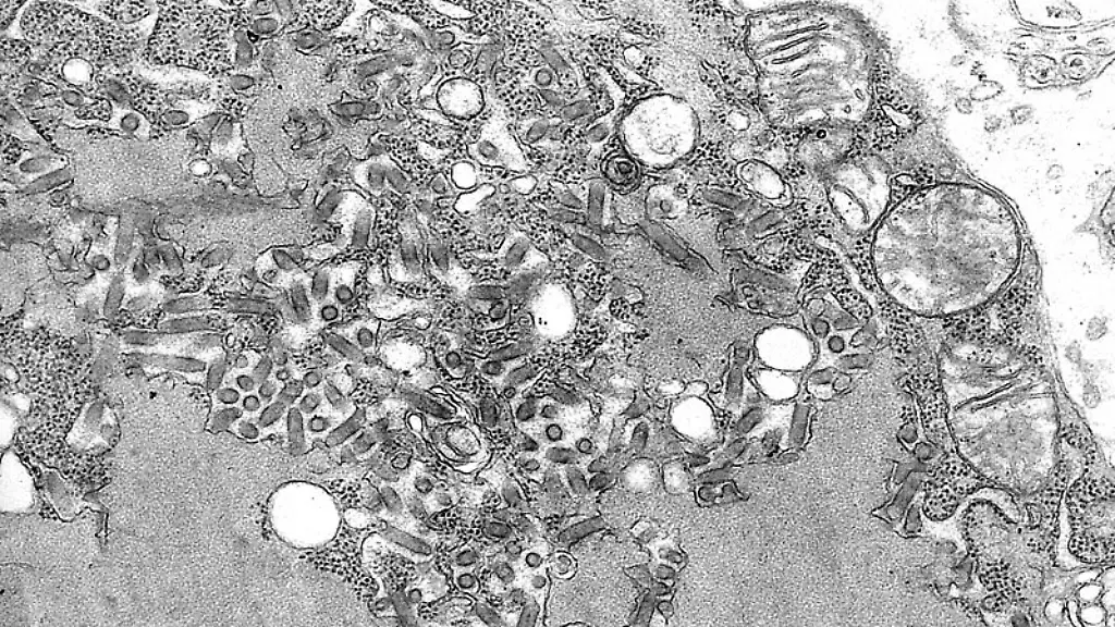 Rabies-Virus-EM-PHIL-1876