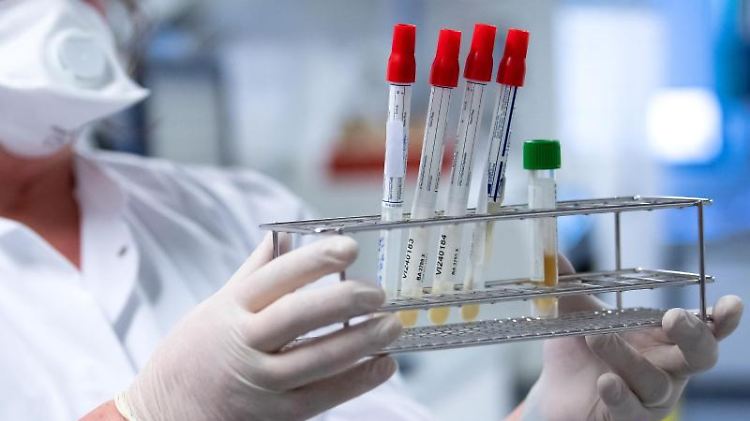 Eine Mitarbeiterin bereitet Proben von Menschen mit Covid-19-Verdacht für die weitere Analyse vor. 