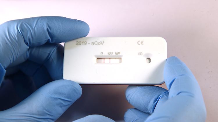 Wissenschaftler pochen auf den verstärkten Einsatz von Corona-Schnelltests.