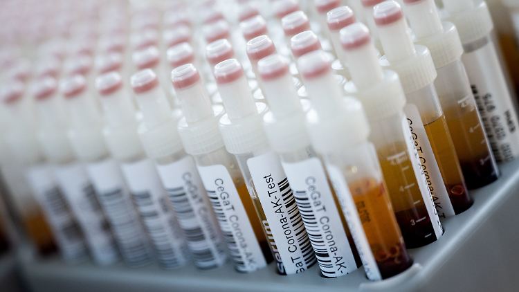 Blutentnahmeröhrchen mit Blutproben für einen Corona-Antikörper-Test - auf diese Weise will das RKI mehr über die Verbreitung des Erregers erfahren.