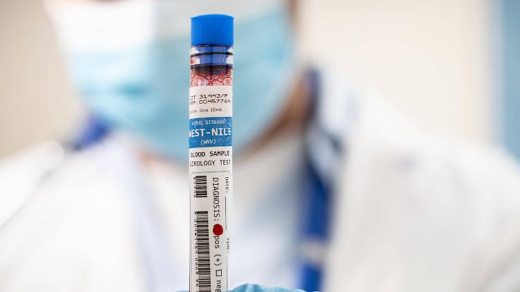 Das West-Nil-Virus ist im Blut nachweisbar.