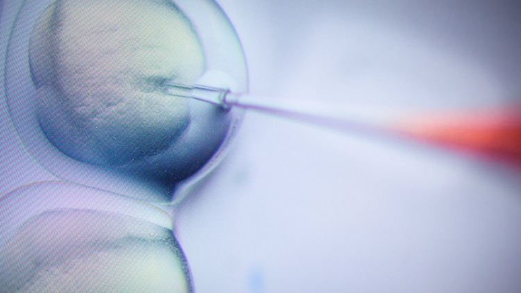 Der Einsatz des Crispr/Cas9-Verfahrens ist in einem Labor eines Zentrums für Molekulare Medizin in vielfacher Vergrößerung auf einem Monitor zu sehen. 