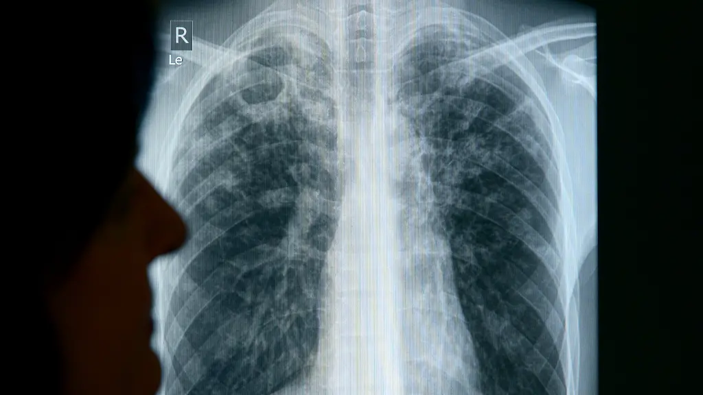 87d16acdd32640c5973f5ebe0f94beb6