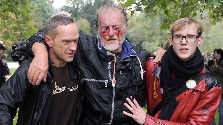 Dietrich Wagner wird am "Schwarzen Donnerstag" von einem Wasserwerfer schwer an den Augen verletzt.