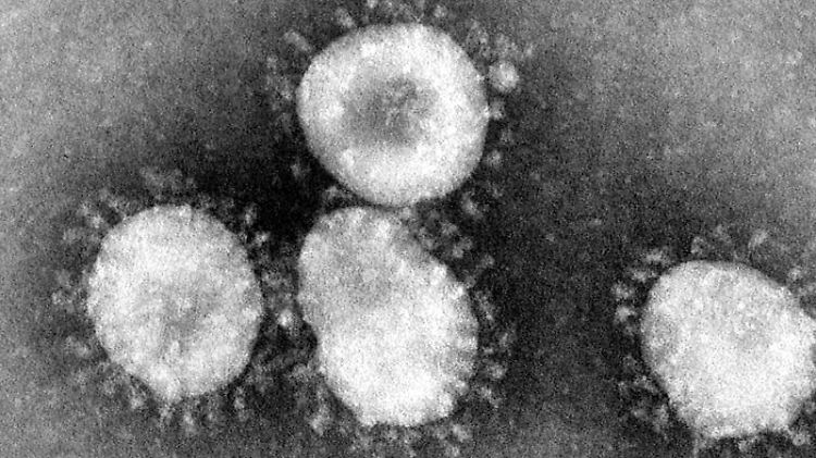 Das Coronavirus dringt bis ins Gehirn vor und löst dort eine Immunreaktion aus.