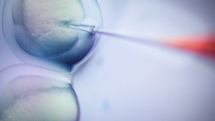 Bei künstlichen In-vitro-Befruchtungen entstehen oft überzählige Embryonen - die sollten Wissenschaftler für die Forschung nutzen dürfen, fordert die Leopoldina. 
